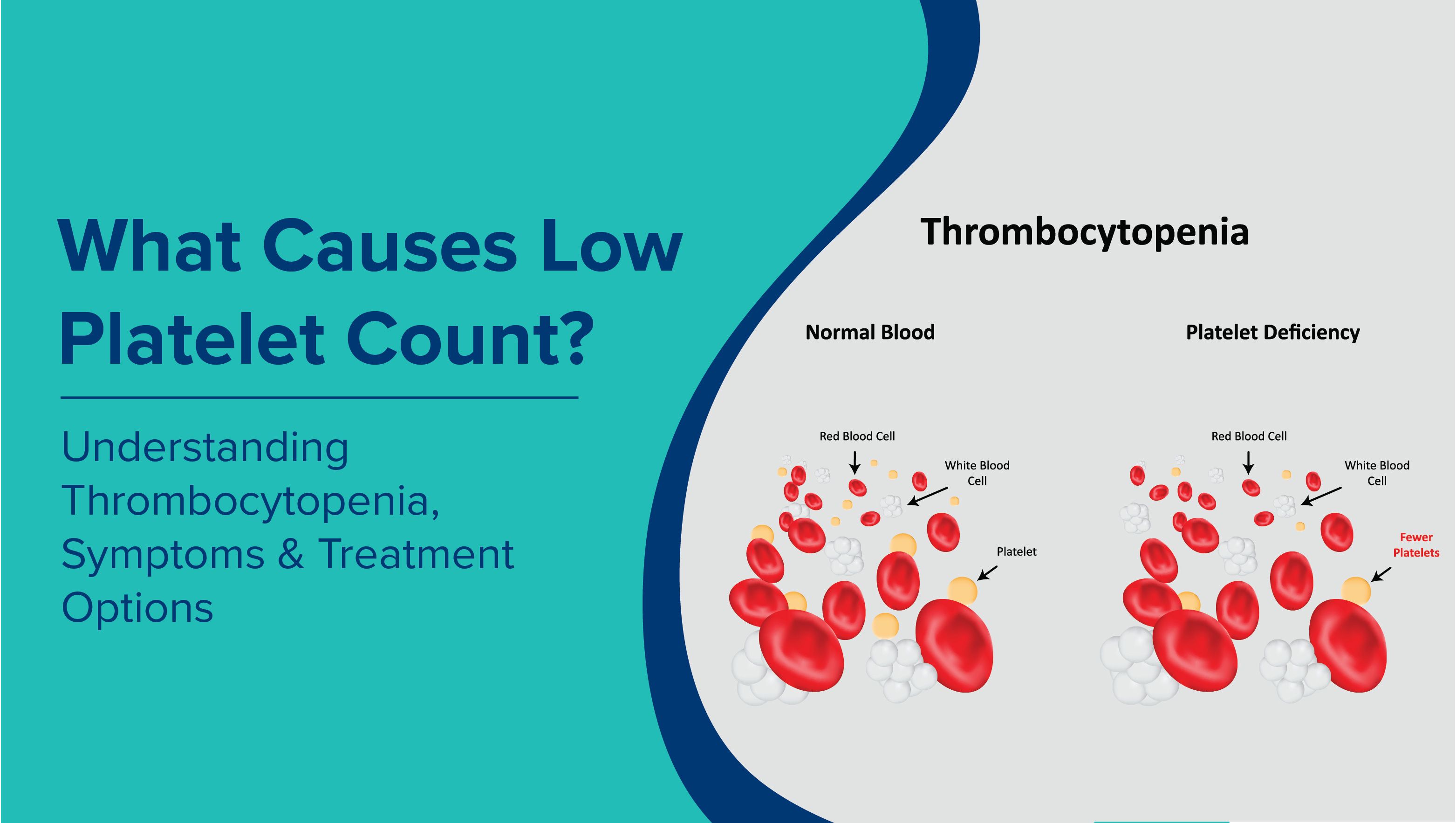 What Causes Low Platelet Count? Understanding Thrombocytopenia, Symptoms, and Treatment Options