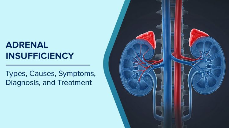 What is Adrenal Insufficiency