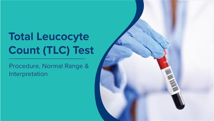 कुल ल्यूकोसाइट गणना परीक्षण (TLC Test in Hindi): प्रक्रिया, सामान्य सीमा और व्याख्या