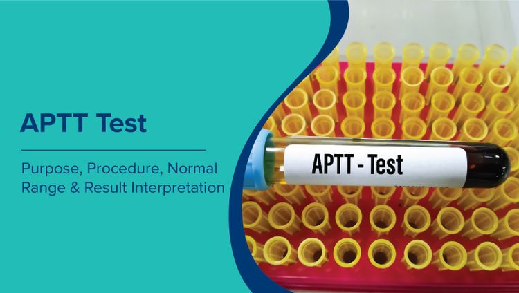 एपीटीटी परीक्षण (APTT Test in Hindi): उद्देश्य, प्रक्रिया, सामान्य सीमा और परिणाम व्याख्या