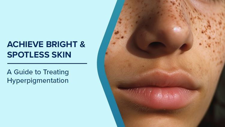 Hyperpigmentation Causes