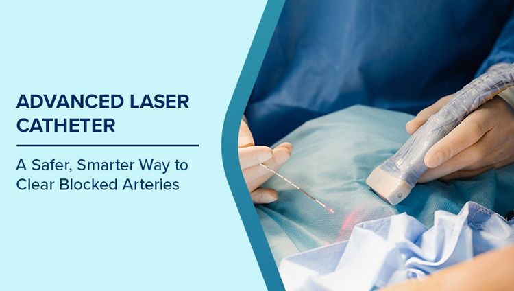 Advanced Laser Catheter for Blocked Arteries