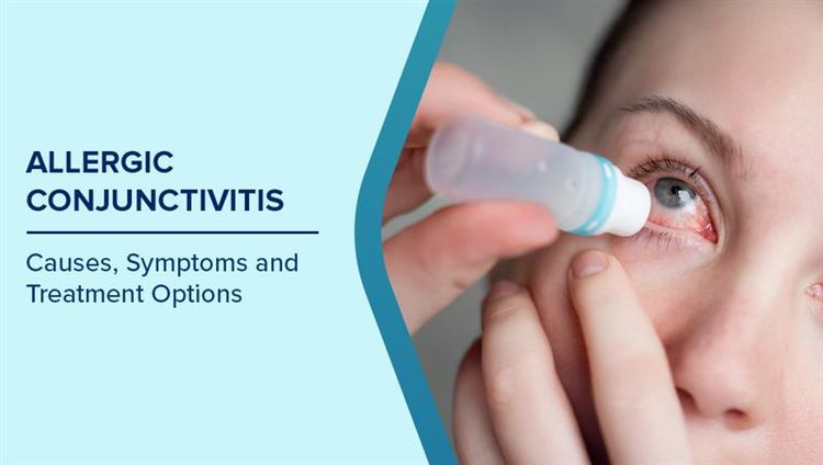 Allergic Conjunctivitis Symptoms