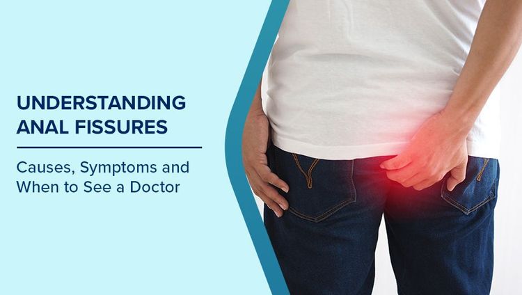 Anal Fissure Symptoms
