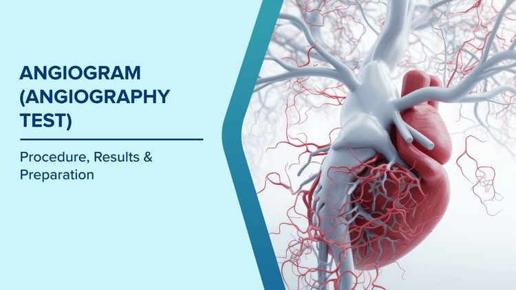 Angiogram Test Procedure