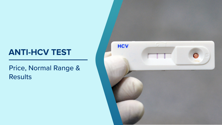 Anti HCV Test Normal Range
