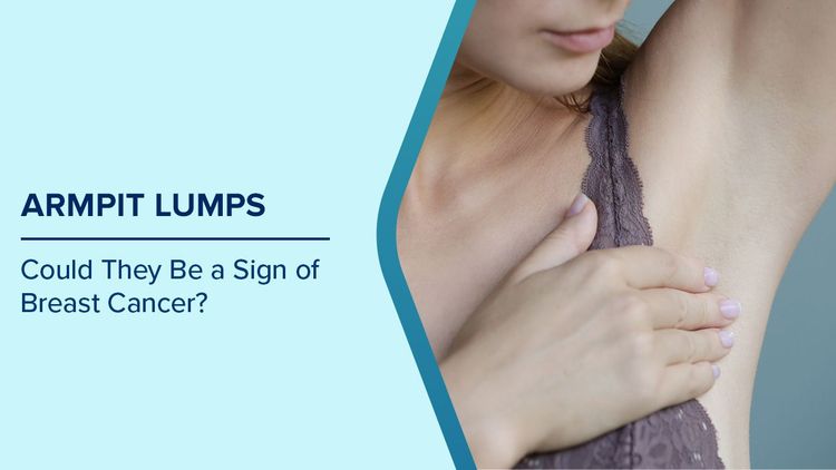 Causes of Armpit Lumps