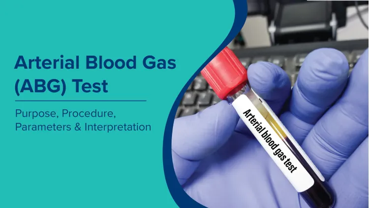धमनी रक्त गैस (एबीजी) परीक्षण (Arterial Blood Gas Test in Hindi): उद्देश्य, प्रक्रिया, पैरामीटर और व्याख्या