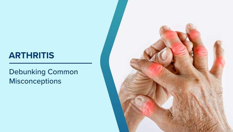 Arthritis Myths and Facts