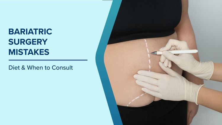 How to Avoid Bariatric Surgery Mistakes