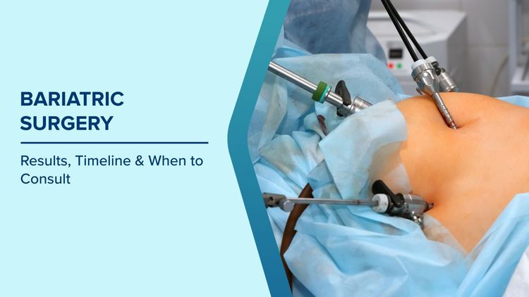 How Bariatric Surgery Helps in Weight Loss