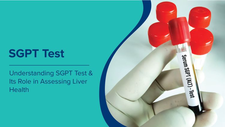 एसजीपीटी परीक्षण (SGPT Test in Hindi) और यकृत स्वास्थ्य के आकलन में इसकी भूमिका को समझना