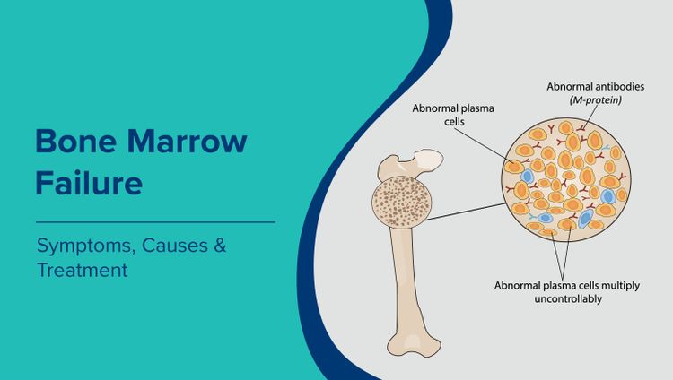 Bone marrow failure symptoms, causes, diagnosis, and treatment