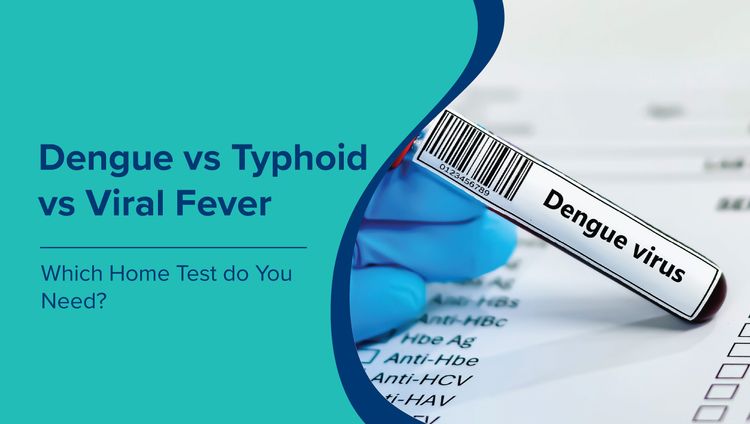 Dengue vs Typhoid vs Viral Fever: Home Test Guide