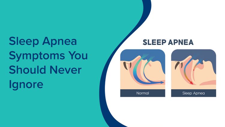 Sleep Apnea Symptoms You Should Never Ignore