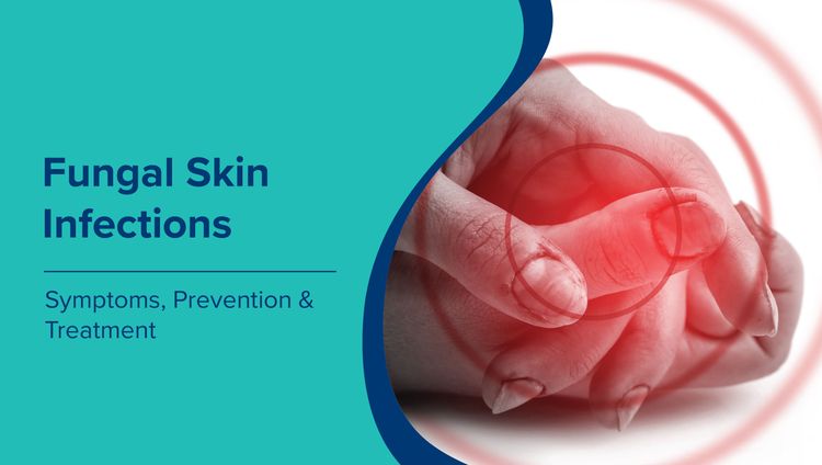 Fungal Skin Infections in Monsoon: Symptoms, Prevention & Treatment