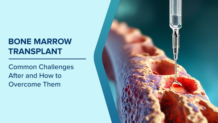 Bone Marrow Transplant Challenges