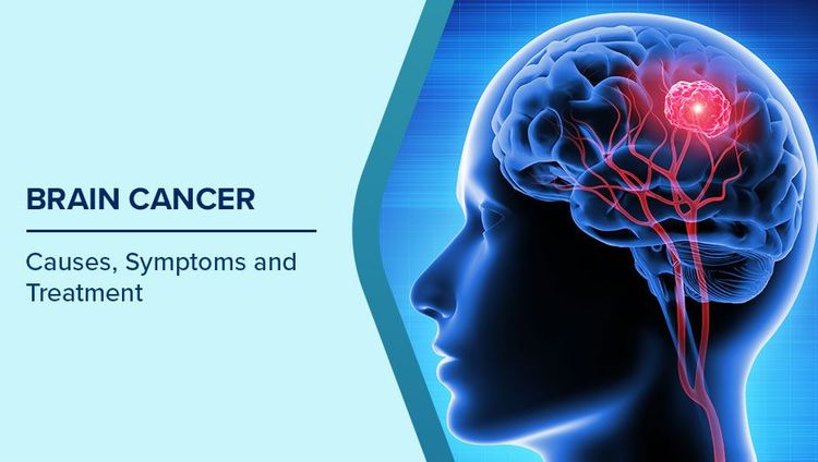 Brain Cancer Symptoms