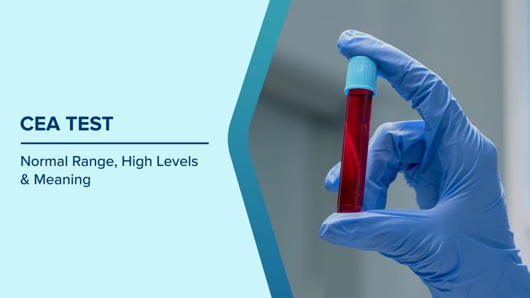 CEA Blood Test