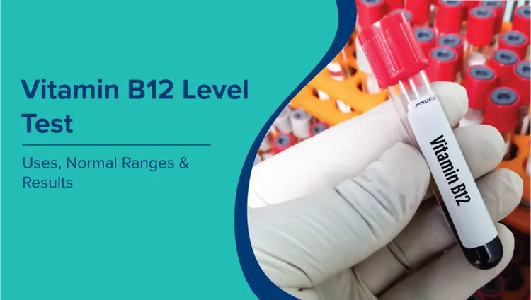 विटामिन बी12 स्तर परीक्षण (Vitamin B12 Level Test in Hindi): उपयोग, सामान्य सीमा और परिणाम