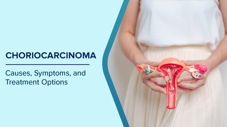 Choriocarcinoma Symptoms