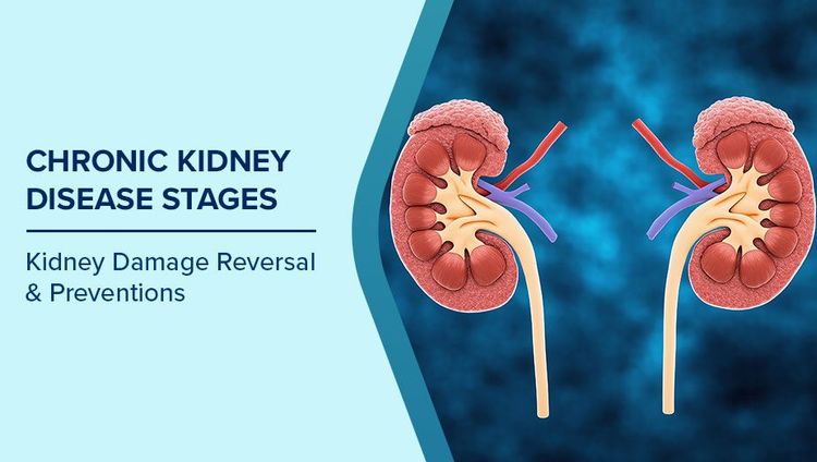 Chronic Kidney Disease Stages