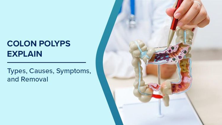 Colon Polyps Symptoms