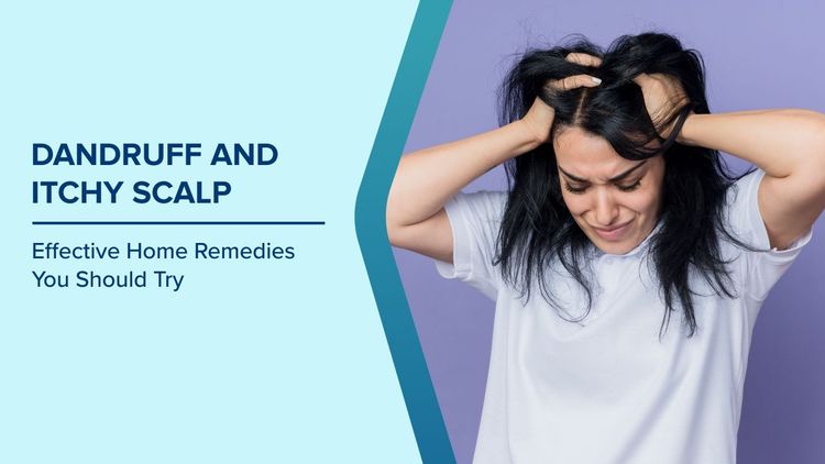 Home Remedies for Dandruff