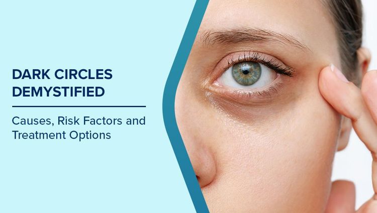 How to Prevent Dark Circles