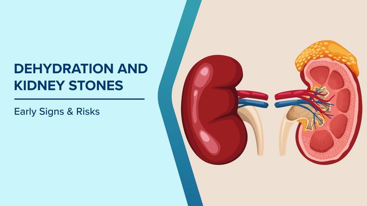 How Dehydration Leads to Kidney Stones