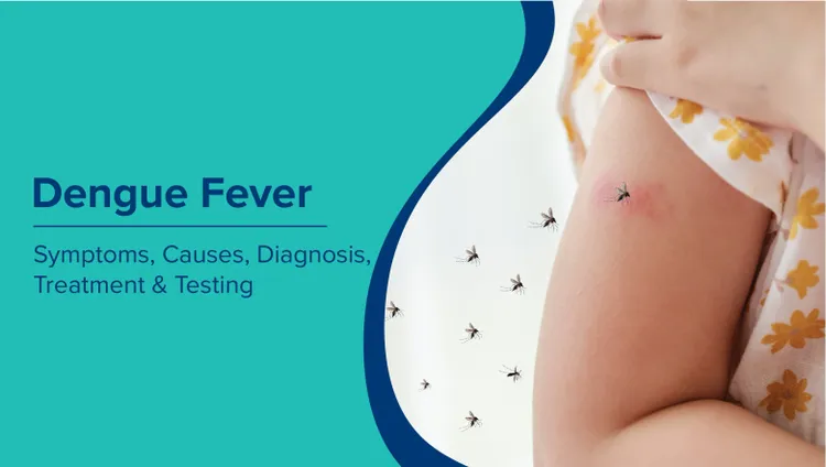 डेंगू बुखार (Dengue Fever in Hindi): लक्षण, कारण, निदान, उपचार और परीक्षण