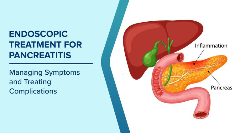 Chronic Pancreatitis and Its Impact

