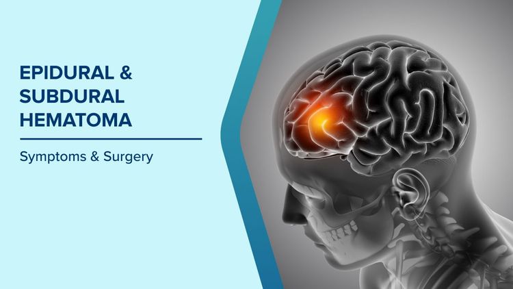 Epidural and Subdural Hematomas Symptoms