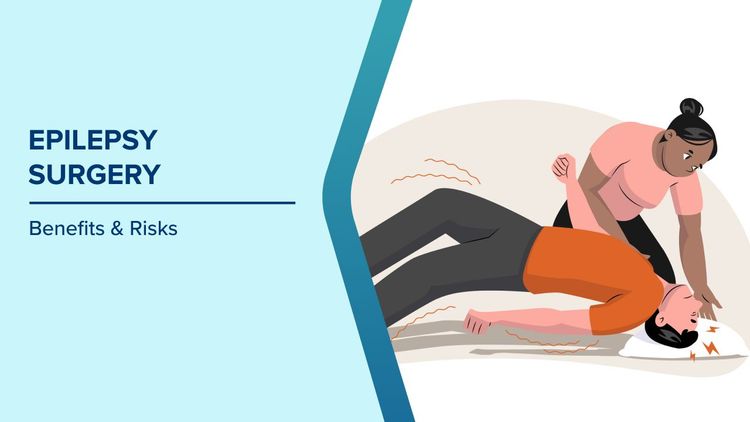 Benefits of Epilepsy Surgery
