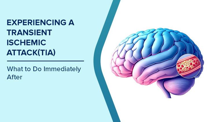 Early Warning Signs of TIA