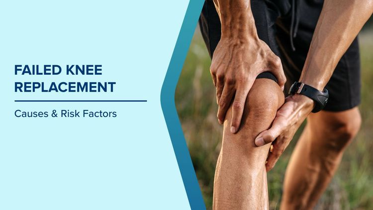 Causes of Failed Knee Replacements