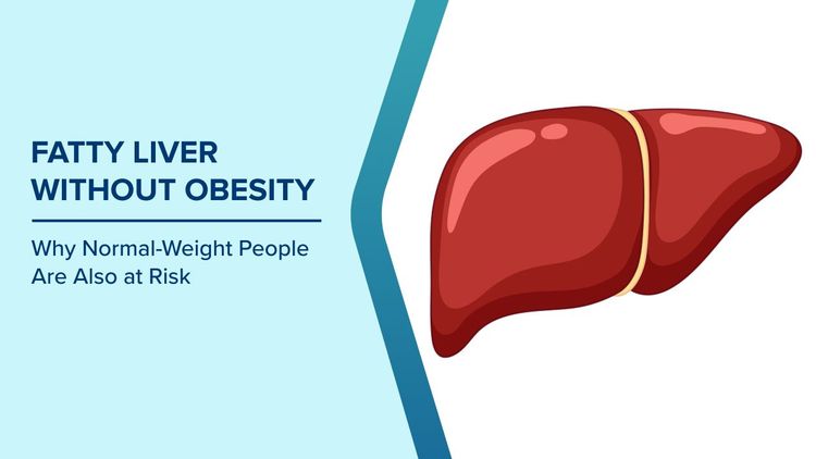 Fatty Liver in Normal Weight People