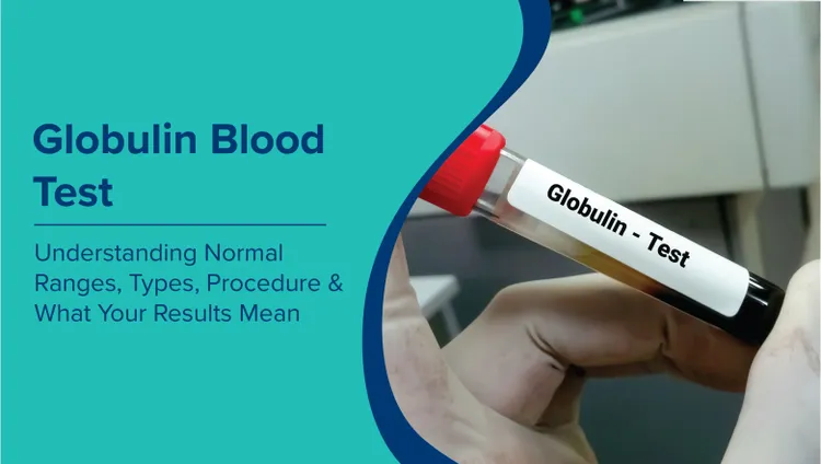 ग्लोब्युलिन रक्त परीक्षण (Globulin Blood Test in Hindi): सामान्य सीमा, प्रकार, प्रक्रिया और आपके परिणामों का अर्थ समझना
