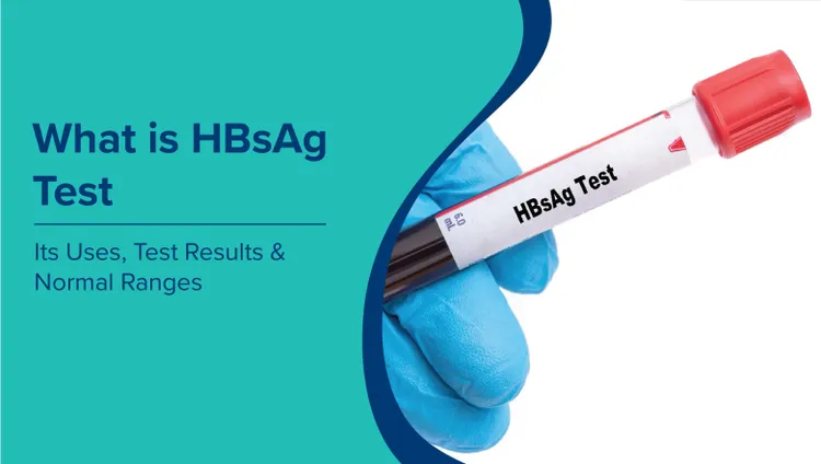 HBsAg परीक्षण क्या है (What is HBsAg Test in Hindi): उपयोग, परीक्षण परिणाम और सामान्य सीमा