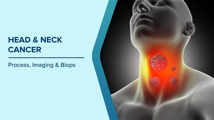 Head and Neck Cancer Diagnosis