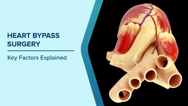 What is Heart Bypass Surgery
