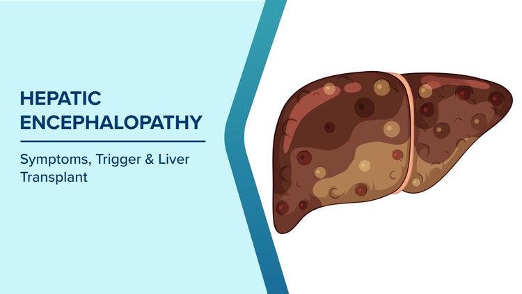 Hepatic Encephalopathy Symptoms