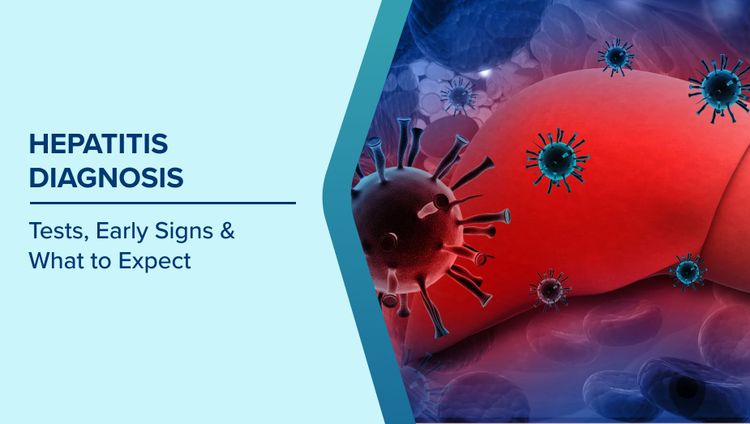 Hepatitis Diagnosis
