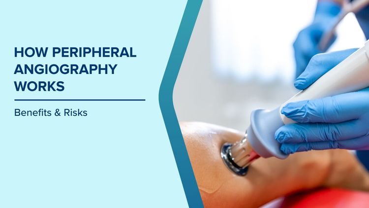 Benefits of Peripheral Angiography