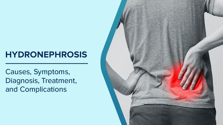 What is Hydronephrosis