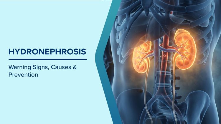 Hydronephrosis Causes