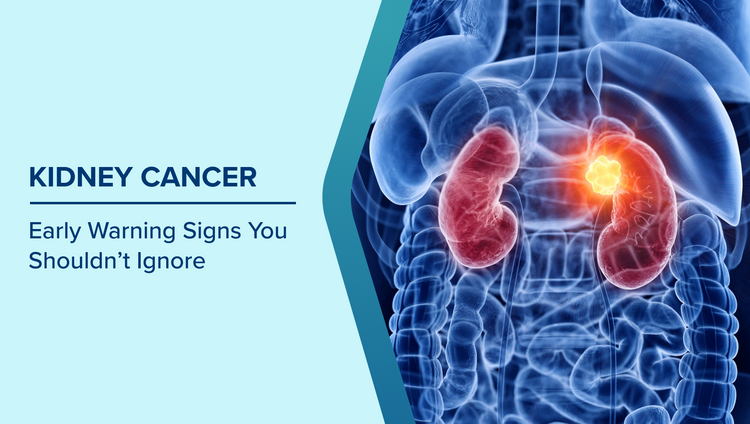 Signs of Kidney Cancer
