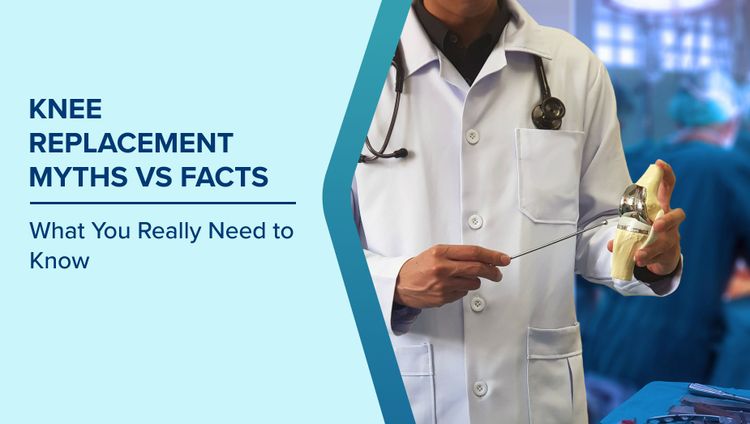 Knee Replacement Myths vs Facts