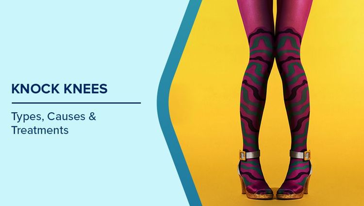 Genu Valgum Causes