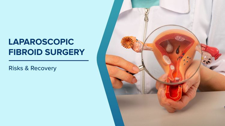 How to Prepare for Laparoscopic Fibroid Surgery